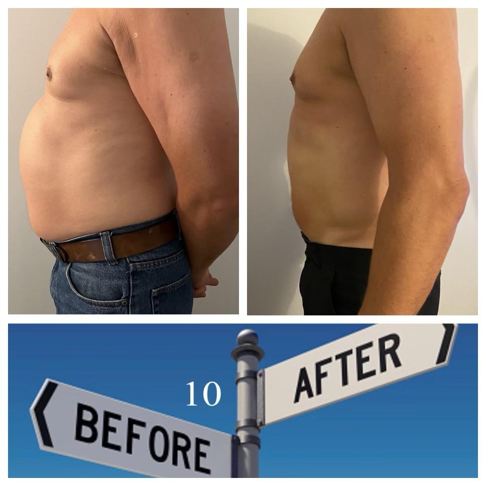 XR7 Muscle Stimulation