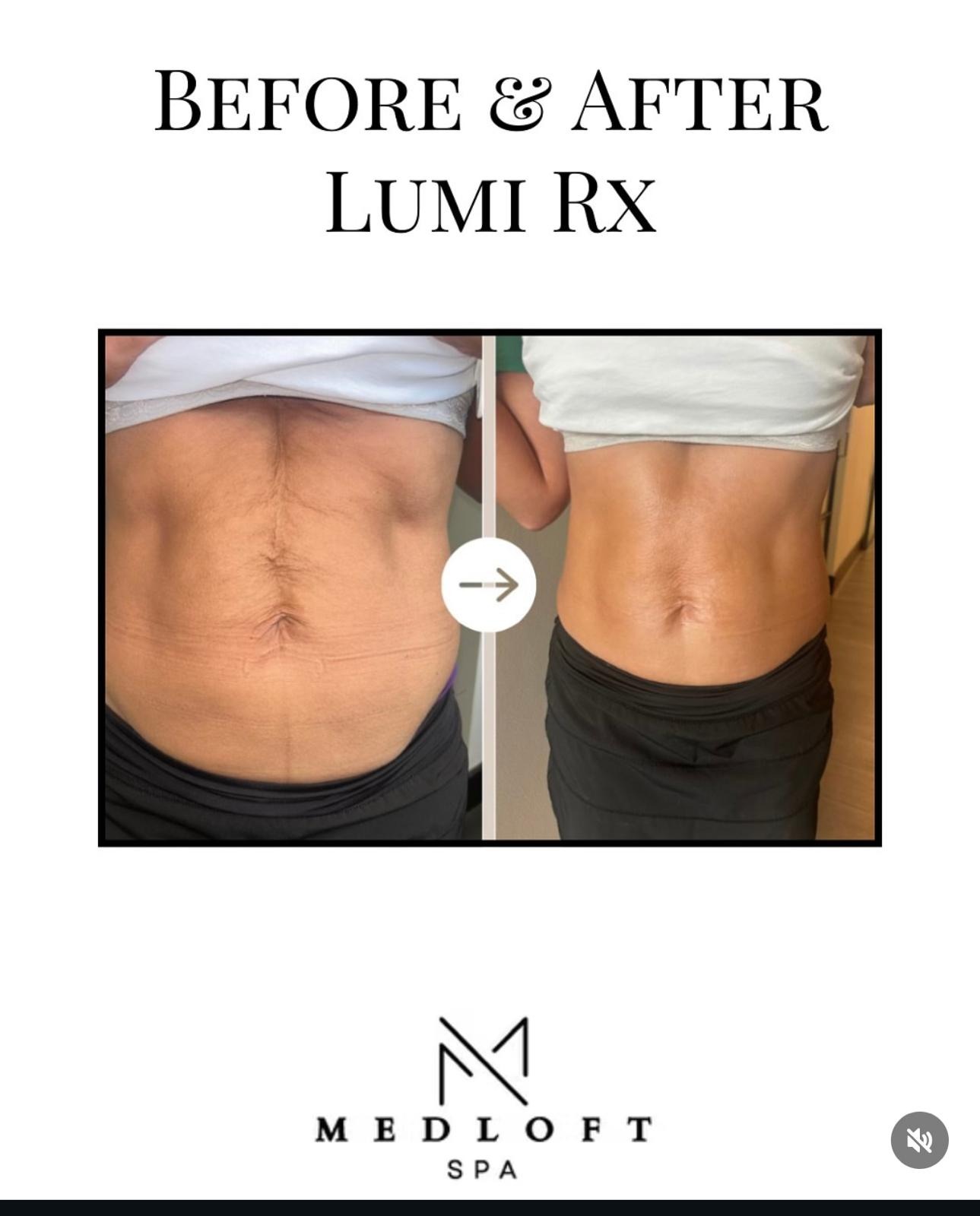 Lumi Rx